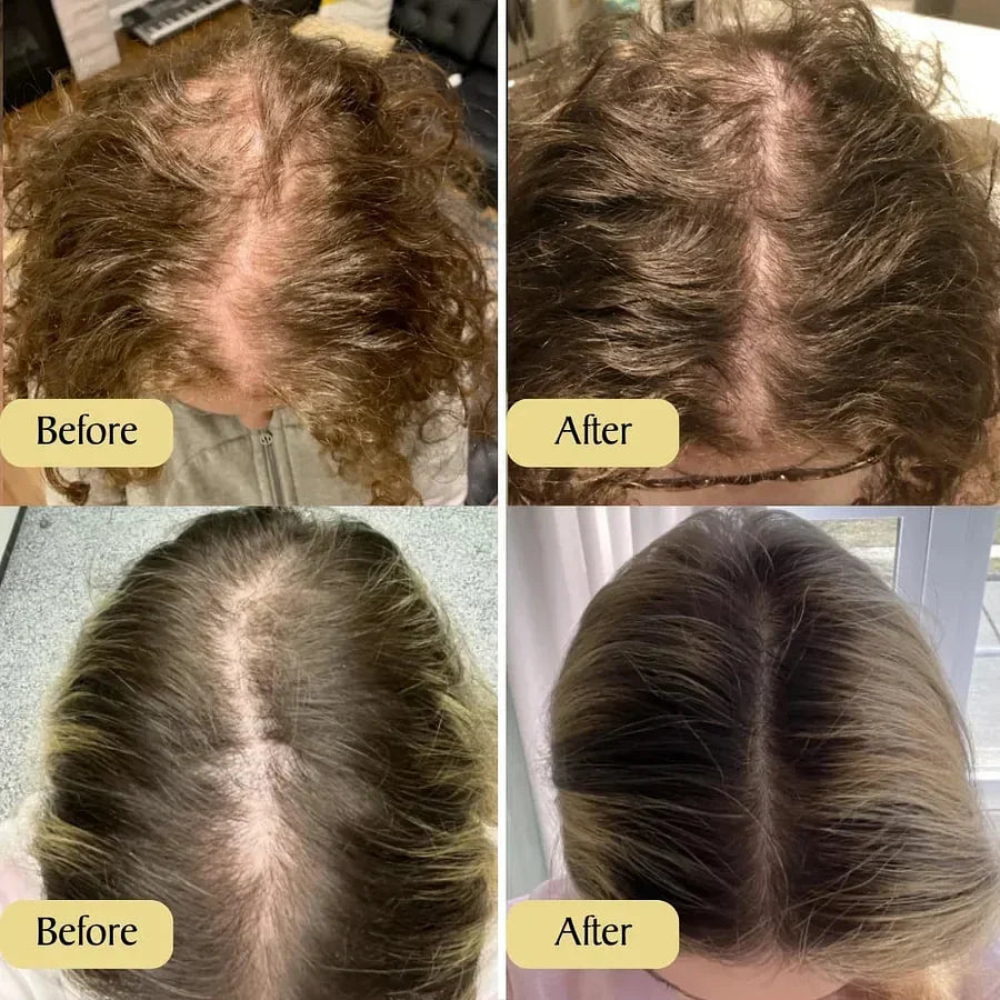 Hair Growth Deoxyribose Scalp Roll-On Serum