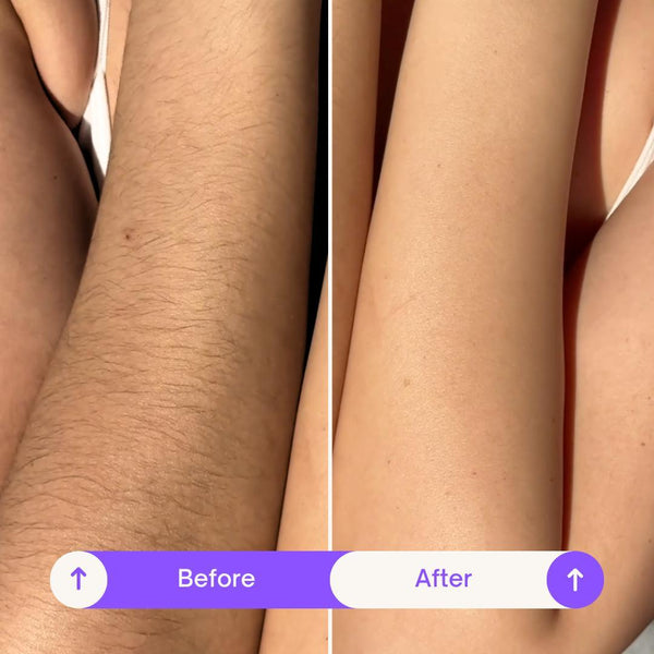 200ml Body Hair Removal Cream